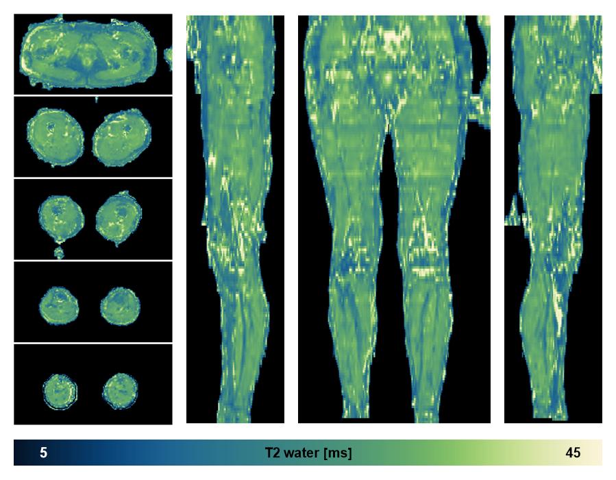 The water only T2 relaxation time of the lower extremity obtained from multi echo spin echo t2 mapping with EPG based reconstruction.